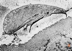 Giardia (Lamblia) intestinalis